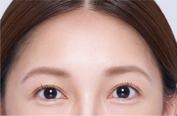 整った丸いヘアラインに