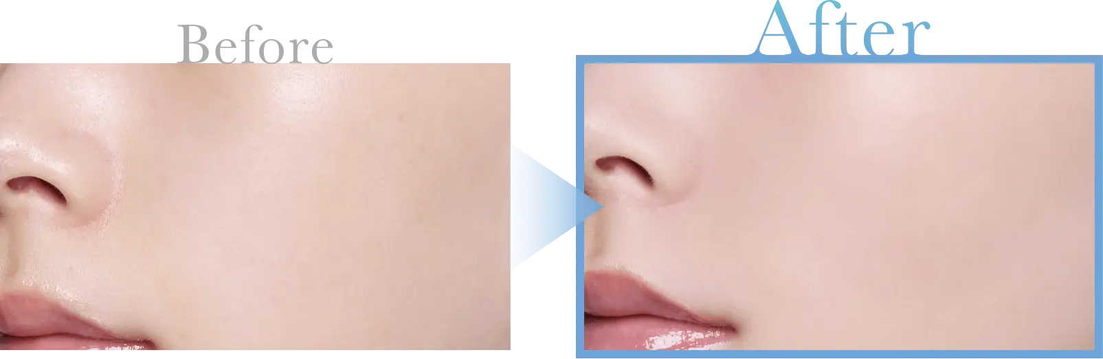 マットクリアカラーの前後比較画像