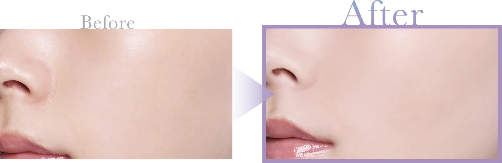 マットクリアカラーの前後比較画像